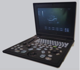 CN-818 Full Digital Laptop Ultrasound Scanner 