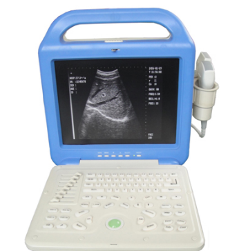  CN-518 Plus Portable Ultrasound Scanner