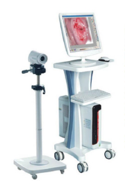 CN-100B Digital Colposcope Imaging System 